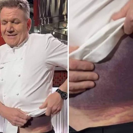 You won’t believe what Gordon Ramsay said after his life-threatening accident!