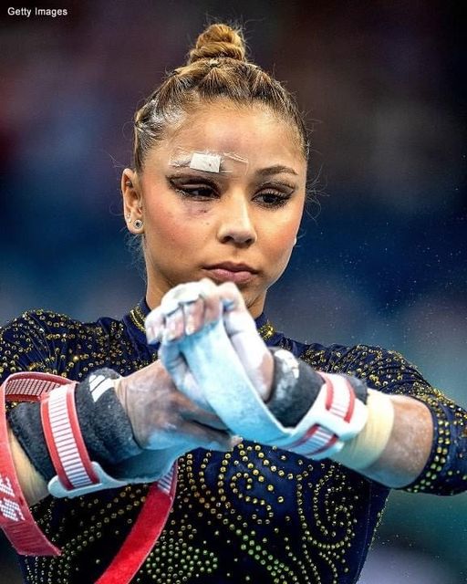 Why Did Flavia Saraiva Compete at the Olympics with a Bandaged Face – Top 3 Gymnast Injuries This Year