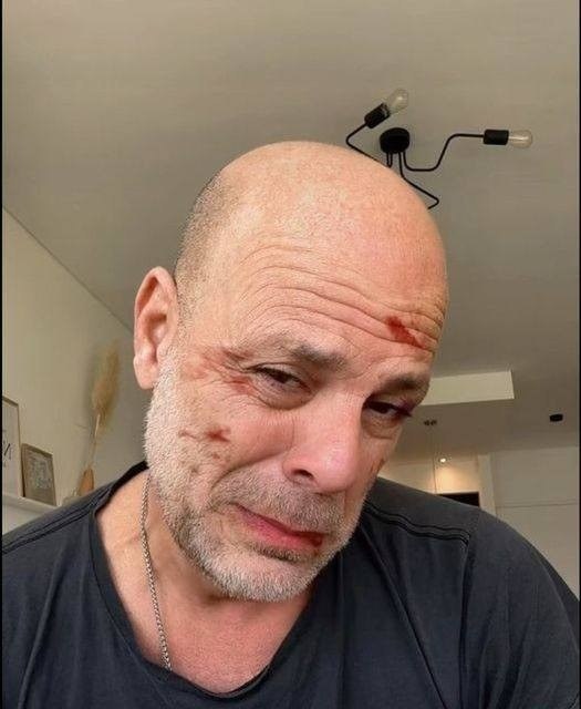 Bruce Willis’ wife Emma Heming shares heartbreaking video of him after his dementia diagnosis